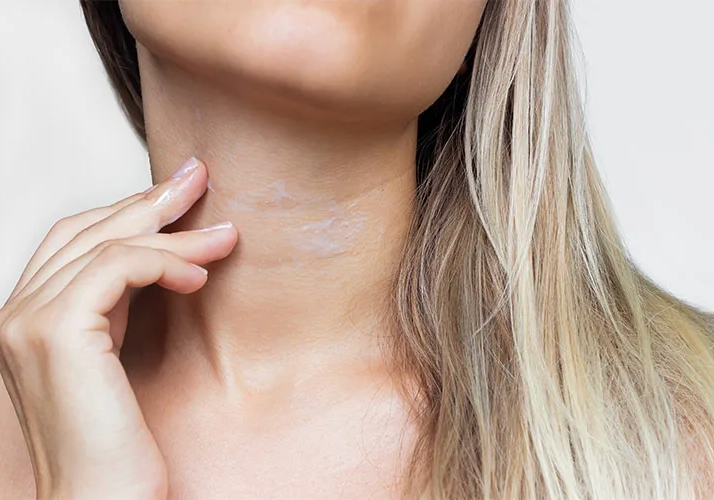 Увлажняющий крем