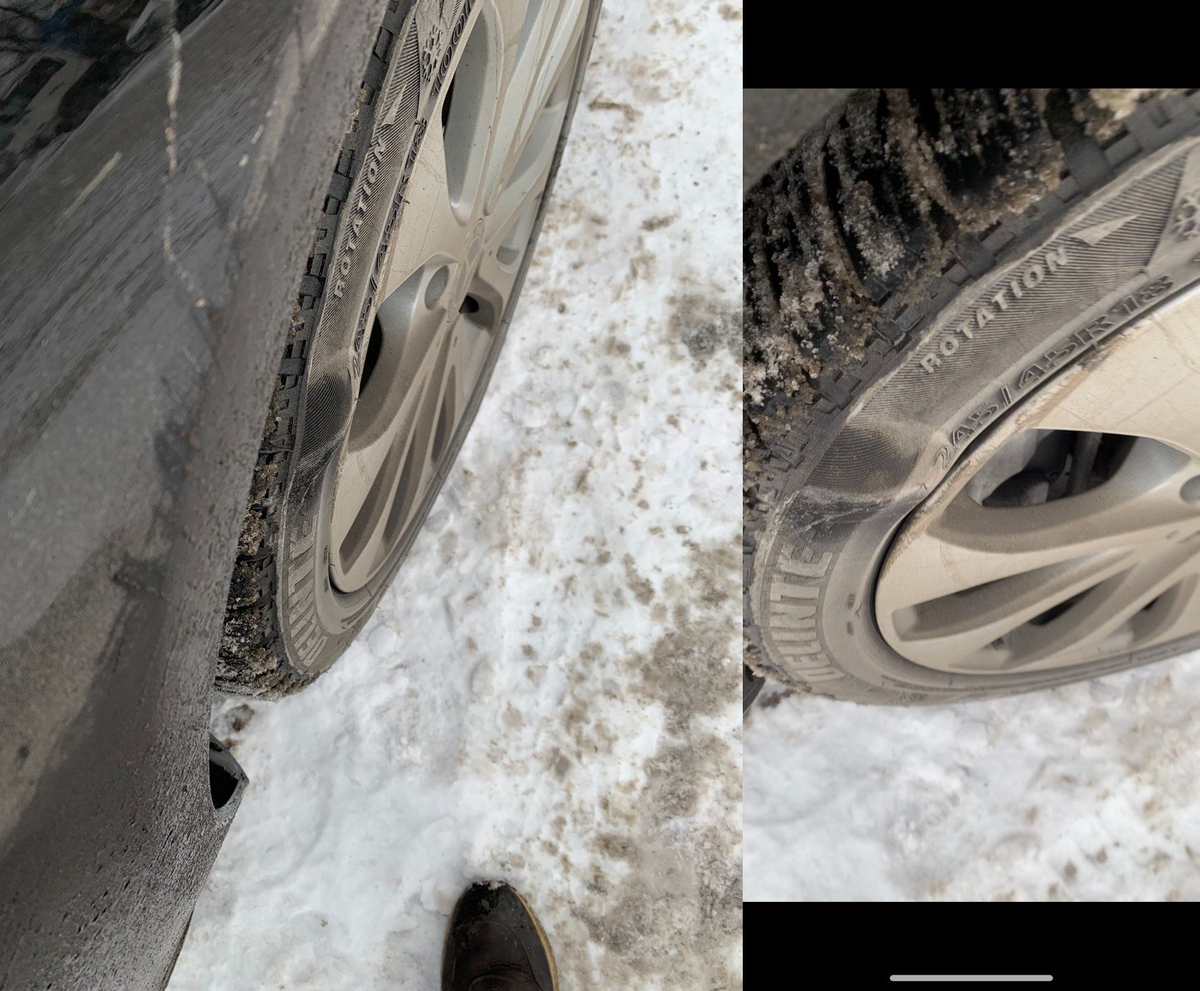 Фотография грыжи днем. После ночного попадания в яму.