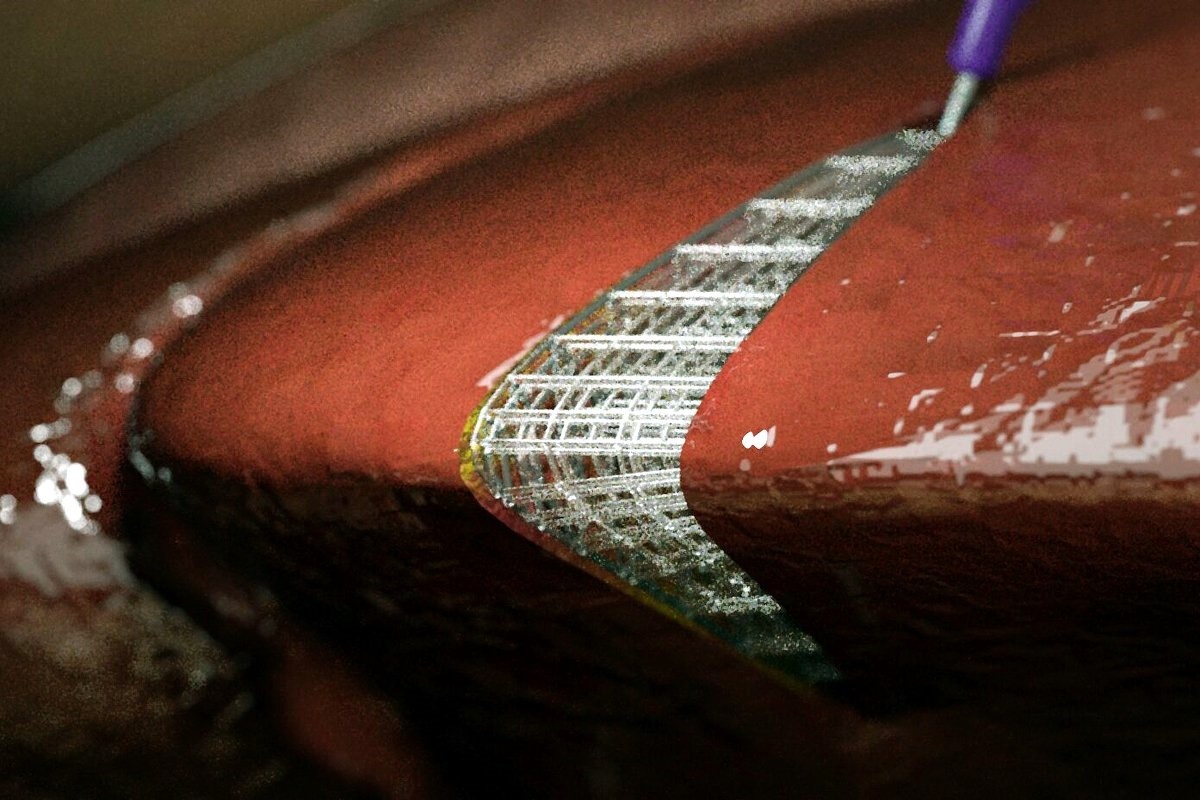 Восстановление ткани органов с помощью 3D-биопечати.