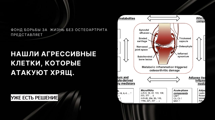 Одна из главных причин артроза