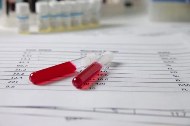    Что такое СОЭ — скорость оседания эритроцитов?