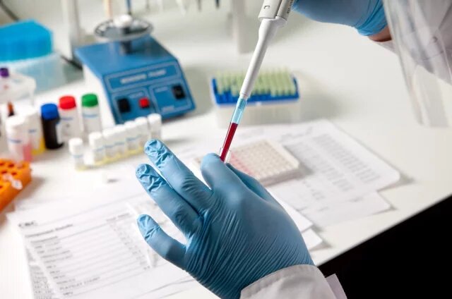    Что делать, если повышена щелочная фосфатаза?