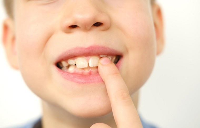    Shutterstock/FOTODOM