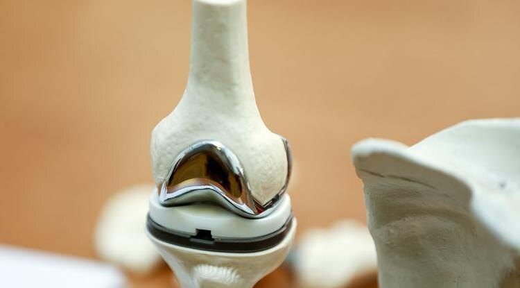 Макет искусственных суставовФото: Павел Колядин (архив)