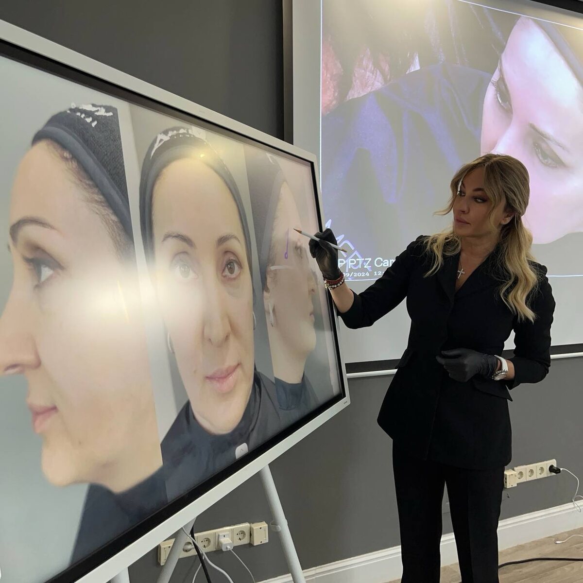 ИМЕЮТСЯ ПРОТИВОПОКАЗАНИЯ, НЕОБХОДИМА КОНСУЛЬТАЦИЯ СПЕЦИАЛИСТА