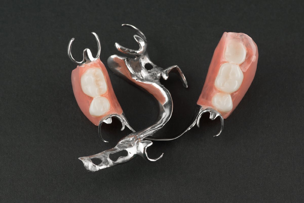 Зубные протезы