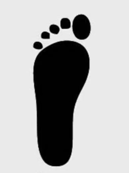 Плоскостопия