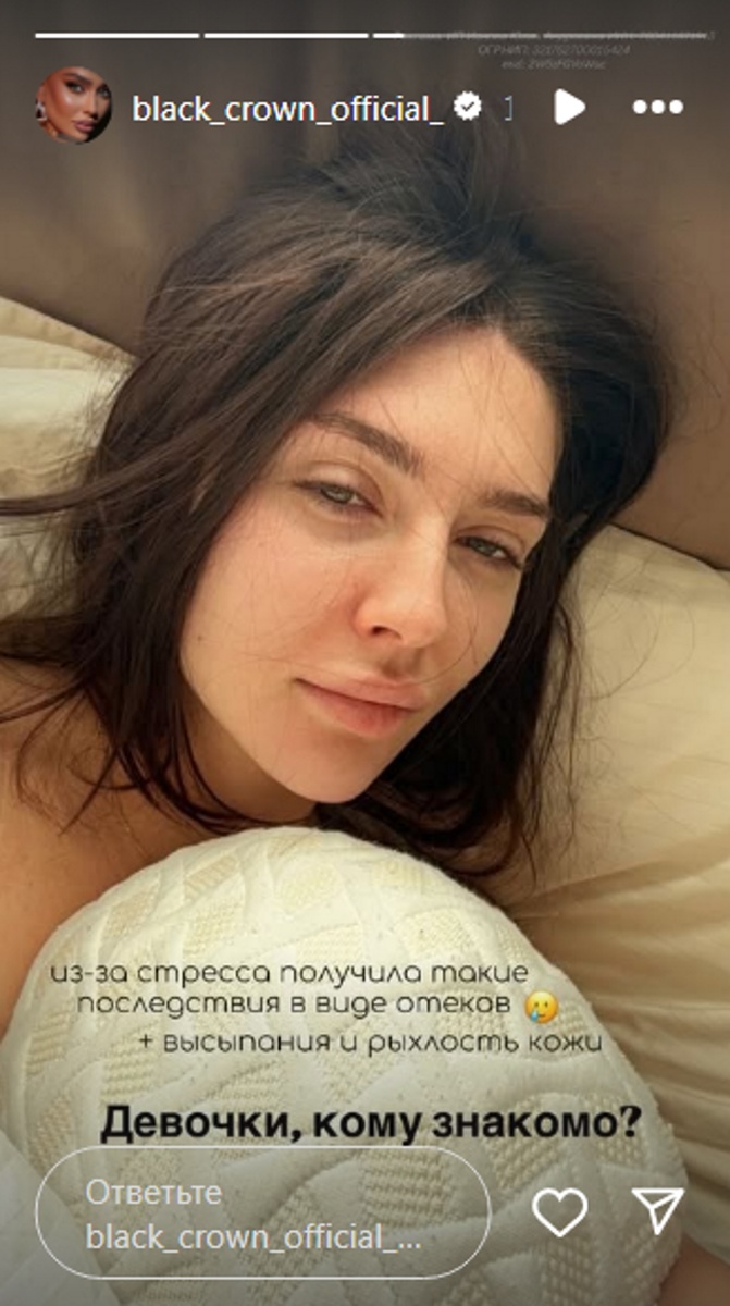 Татьяна Мусульбес пожаловалась на стресс. Фото: соцсети