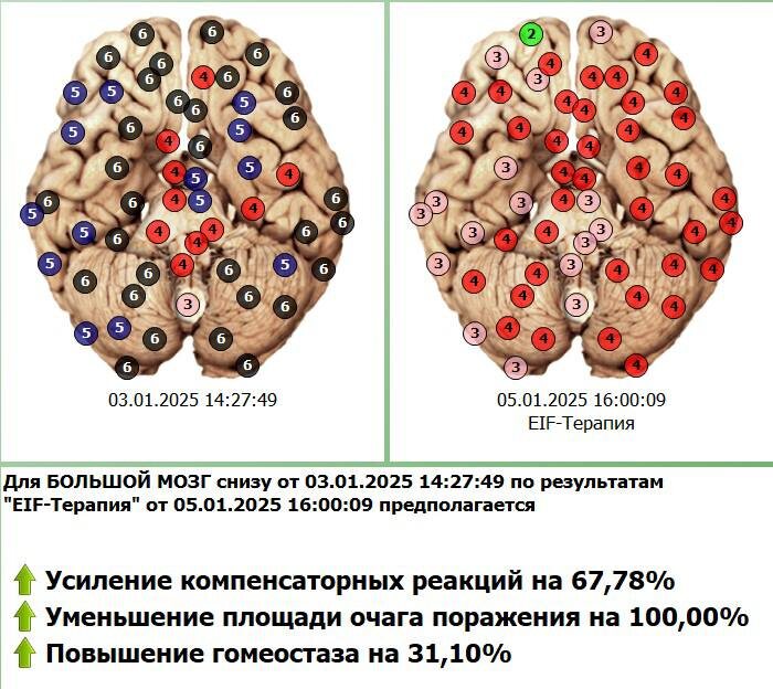 Диагностика физического тела с коррекцией состояния в программе Дианел