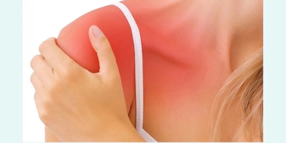 Боль в плече. Артур Сабуров