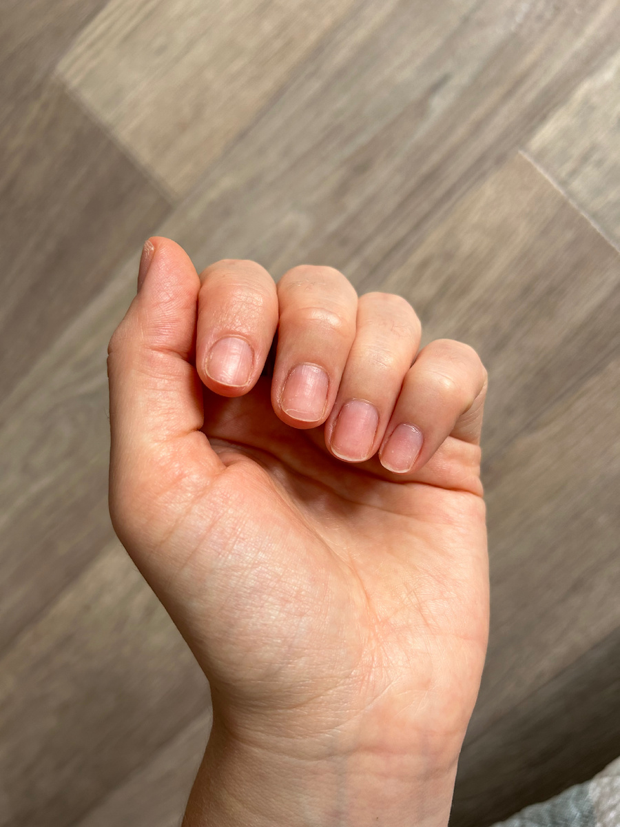 мои ногти после издевательств