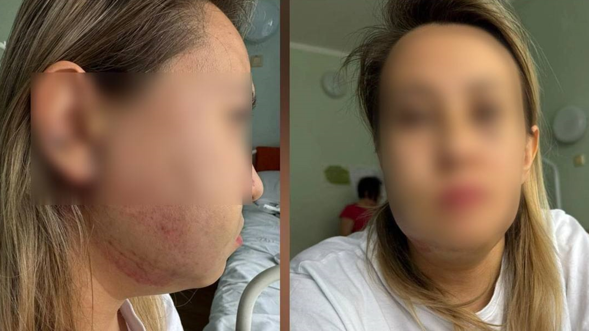 Фото потерпевшей опубликованы Telegram-каналом «Осторожно, новости»