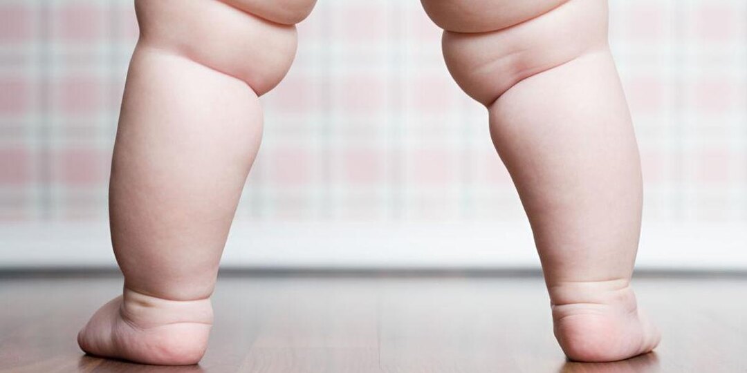 Несимметричные складки у малыша: норма или повод для волнения? Разбираемся с экспертом