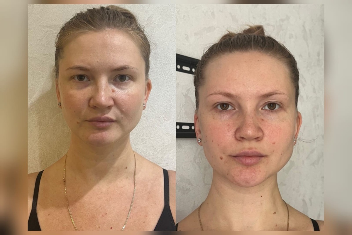 На фото Юлия, 33  года. Пришла с сильными болями в пояснице, отеками и низкой самооценкой