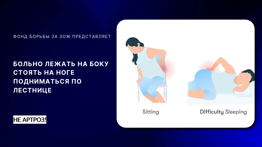 Болевой синдром в бедре с внешней стороны. Срочно заменяем сустав?