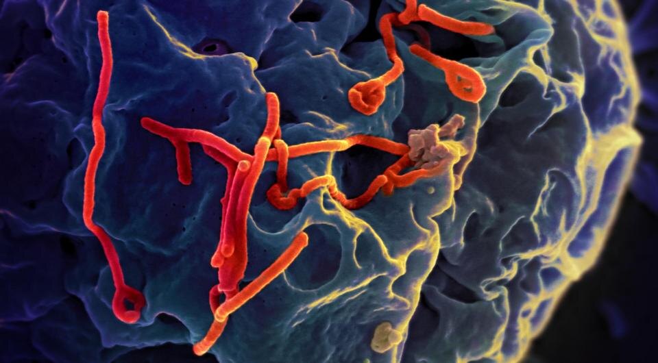   NIAID / Flickr / CC BY 2.0