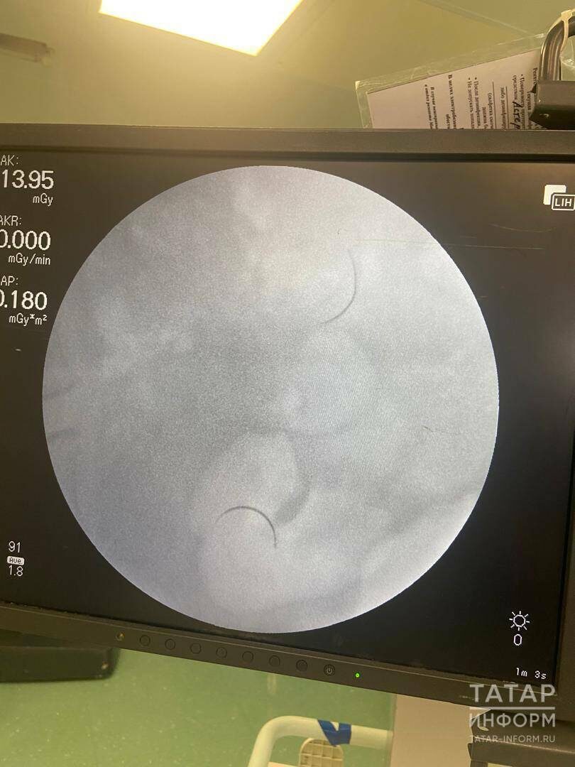 Фото: Пресс-служба РКБ Татарстана