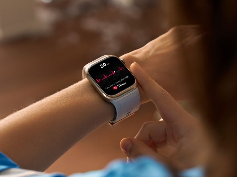    HUAWEI и Xiaomi контролируют почти половину рынка носимых устройств