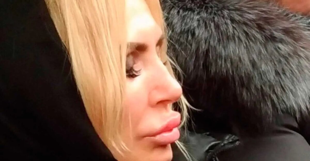 прмерно так выглядел ее ... лицо. Фото из открытых источников.