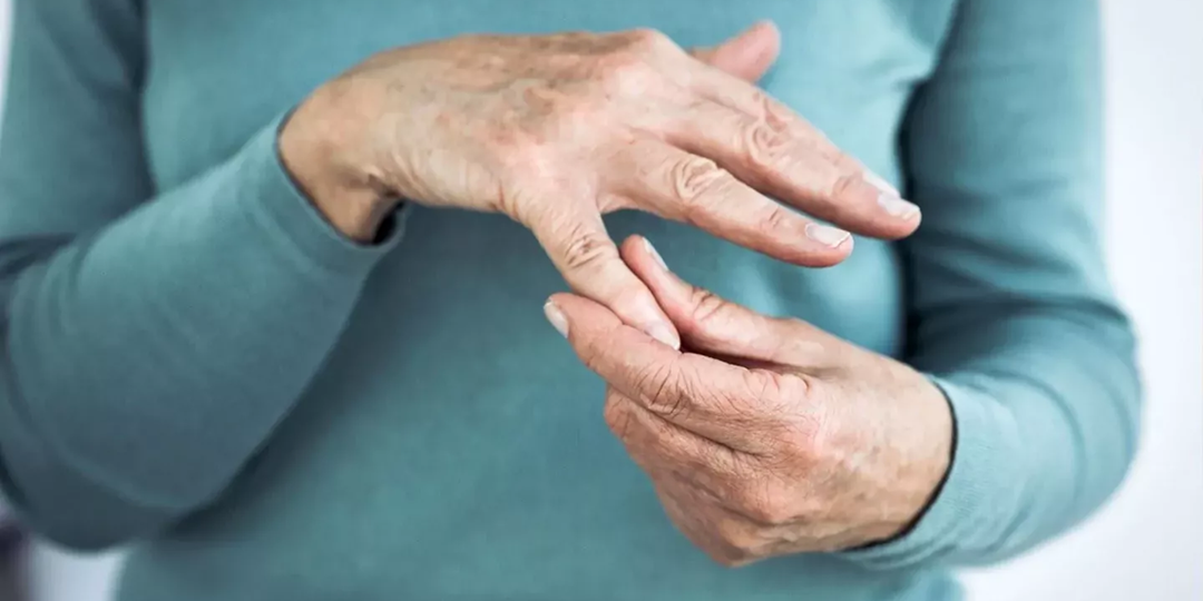 «Узлы на пальцах» — что это такое, почему появляются и что делать?