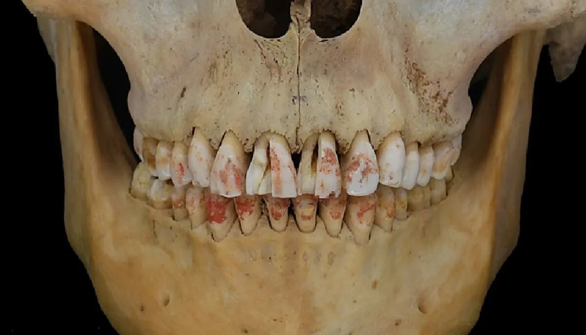 Изображение предоставлено доктором Цянь Ваном, стоматологический колледж Техасского университета A&M,