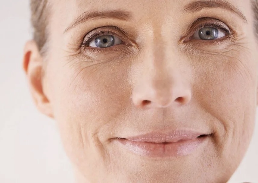 Мимические морщины