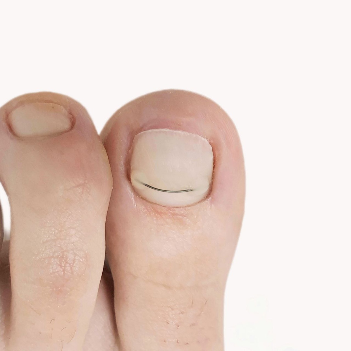 Титановая нить