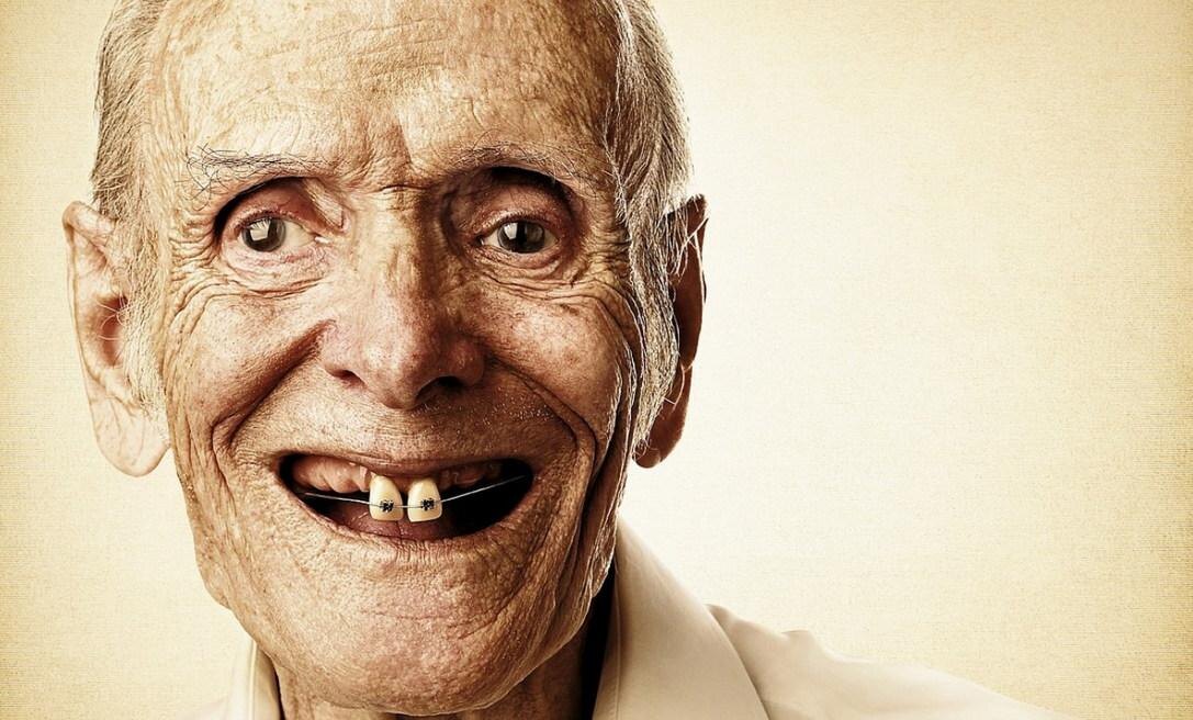 Брекеты при малом количестве зубов
