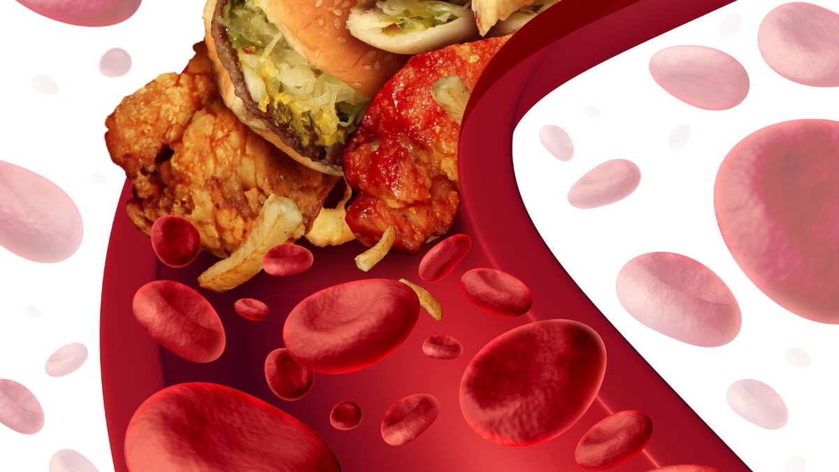 Холестерин: враг или строительный материал? Разбираем мифы с врачом-экспертом