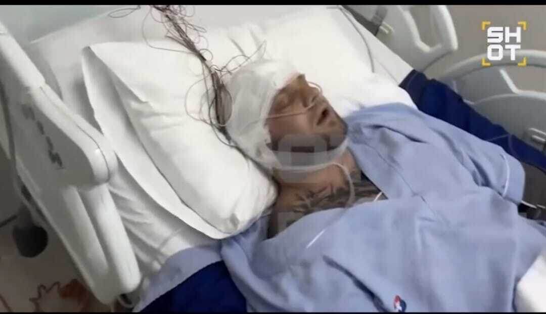 Но больной дышит сам - нет трубки ИВЛ, и это уже неплохо. 