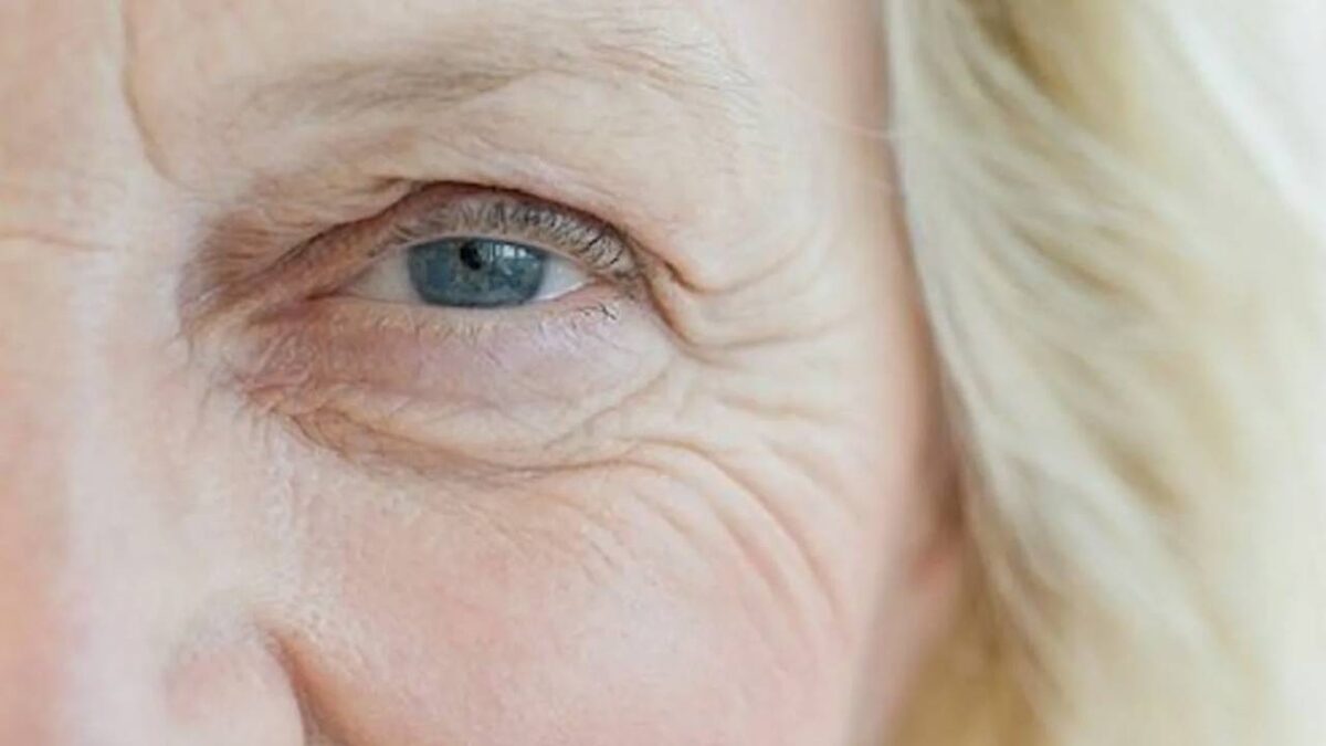 Морщины отражают ваши эмоции и характер