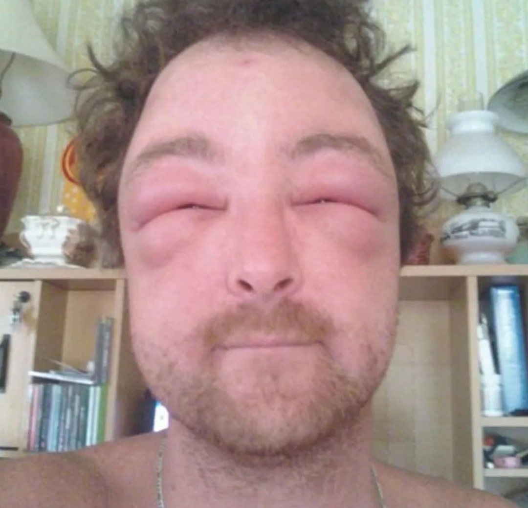 Детина после исследований моллюска