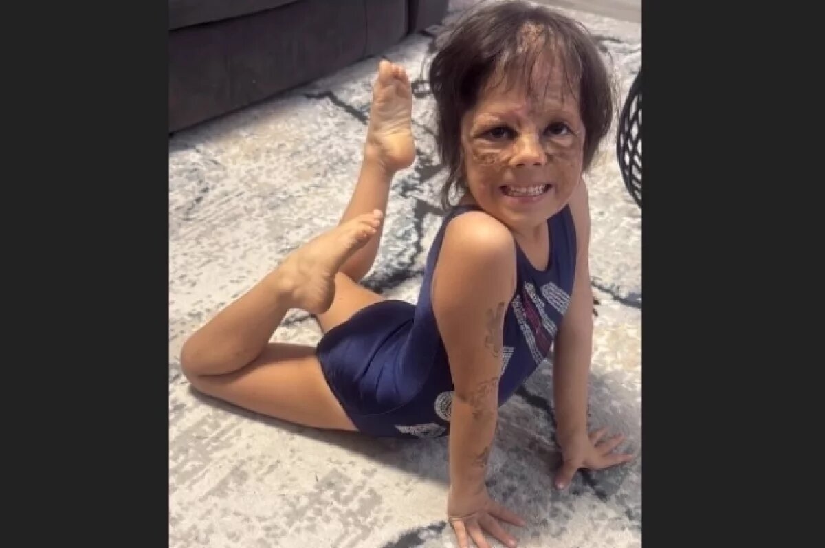    Девочка с маской Бэтмена 1 мая прилетит в Россию на трехмесячное лечение