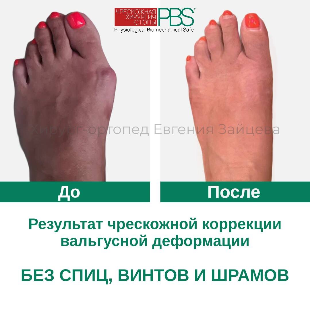 ✔️ Пациентка обратилась ко мне со следующими проблемами: