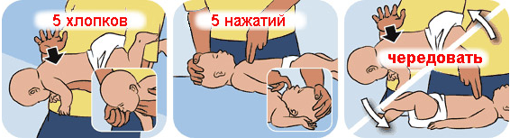 Первая помощь ребенку, который подавился 