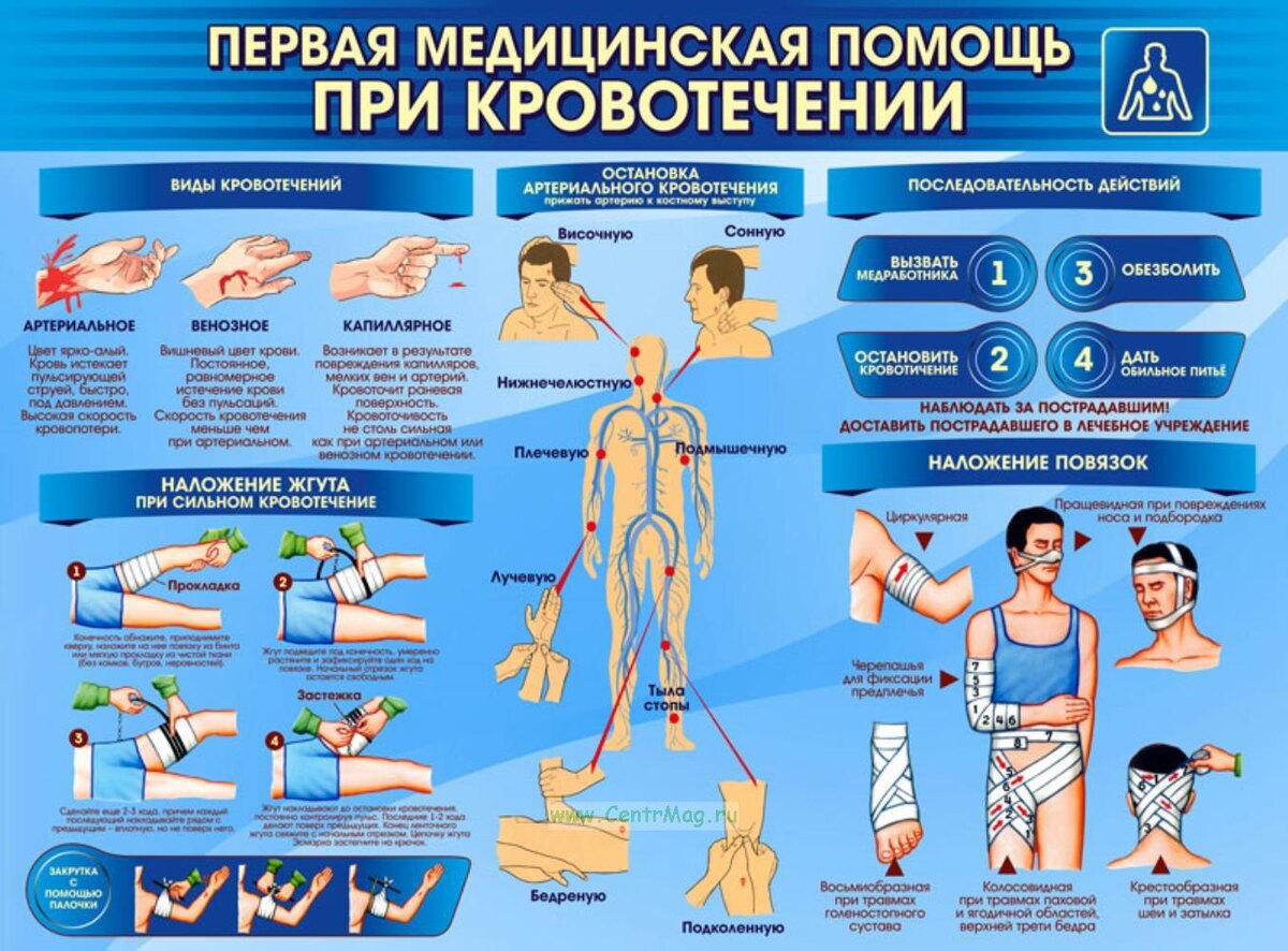 Первая помощь при кровотечениях
