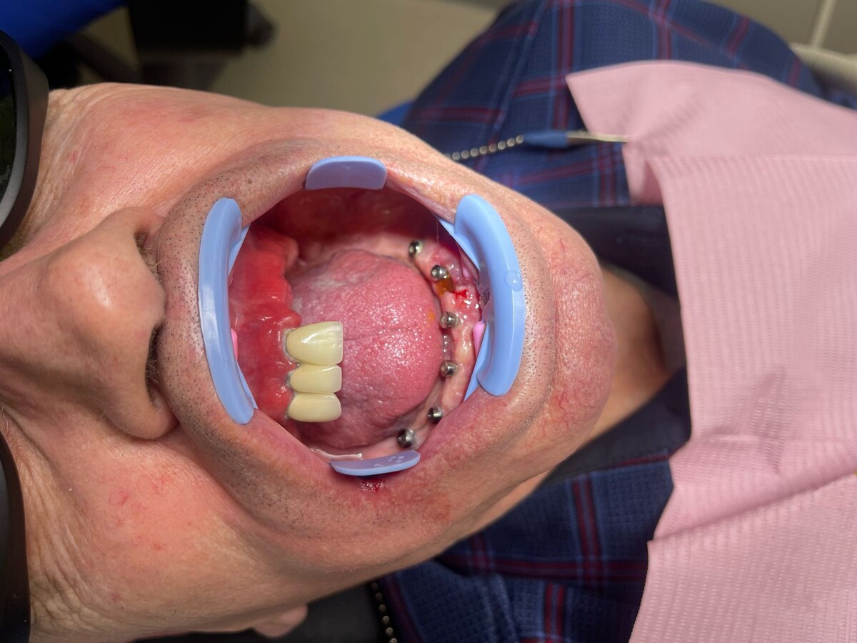 Наш пациент ДО начала лечения