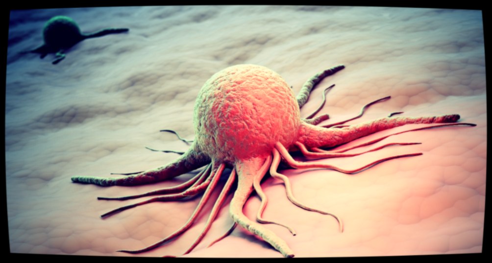 Наше питание вносит свою лепту в развитие рака.