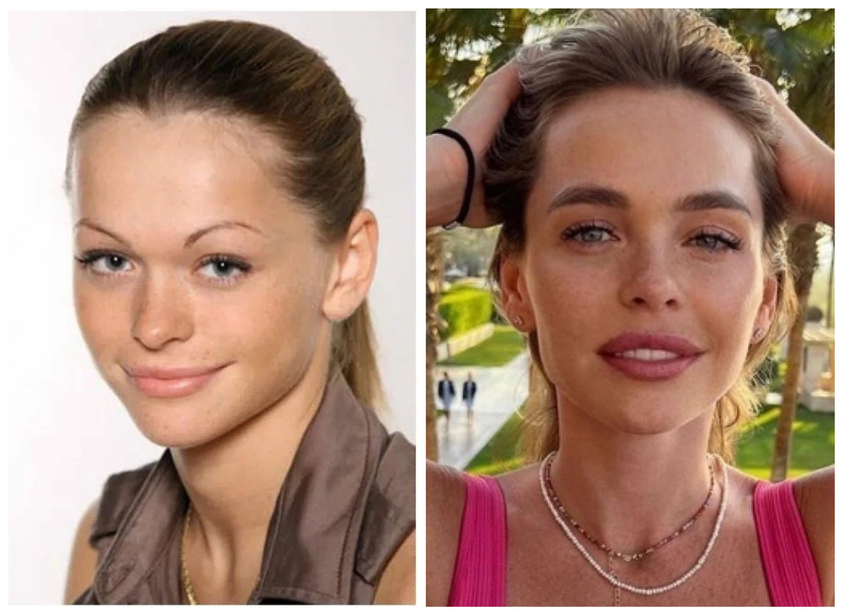 Анна Хилькевич