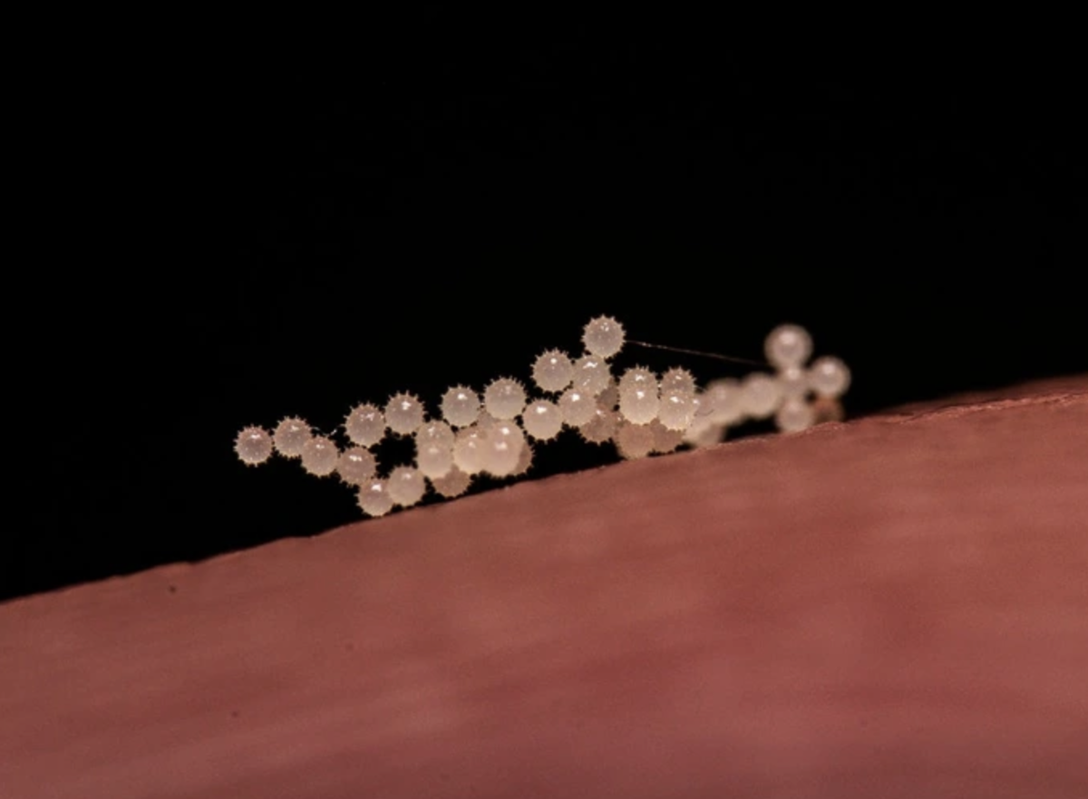   . VBeneveds/ Reddit.