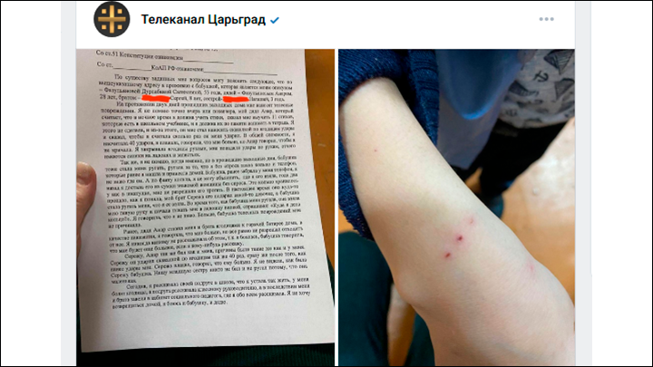    Девочка пожаловалась в школе на систематические истязания со стороны опекунши и её сына//Скриншот поста из ТГ-канала "Царьград ТВ"