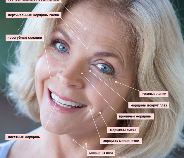 Виды морщин на лице и эффективные способы их коррекции