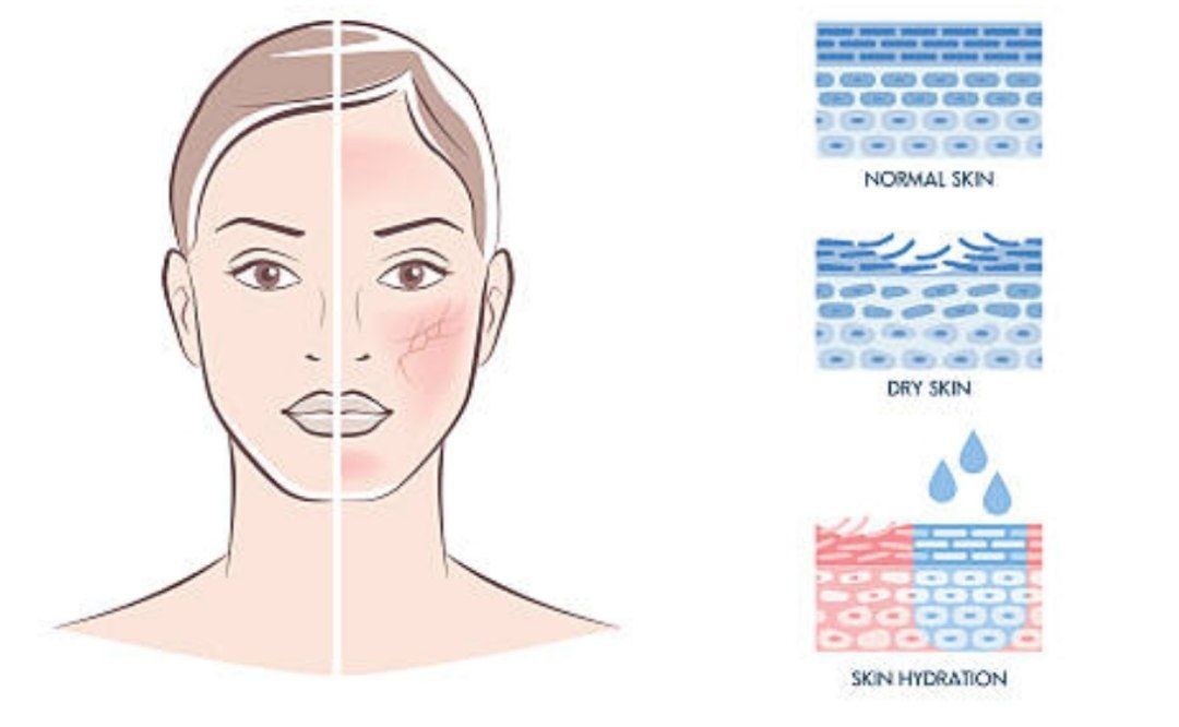 *иллюстрация взята из интернет-источника