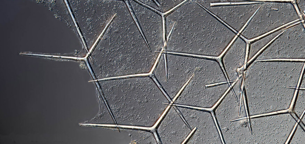 Микроиглы под микроскопом