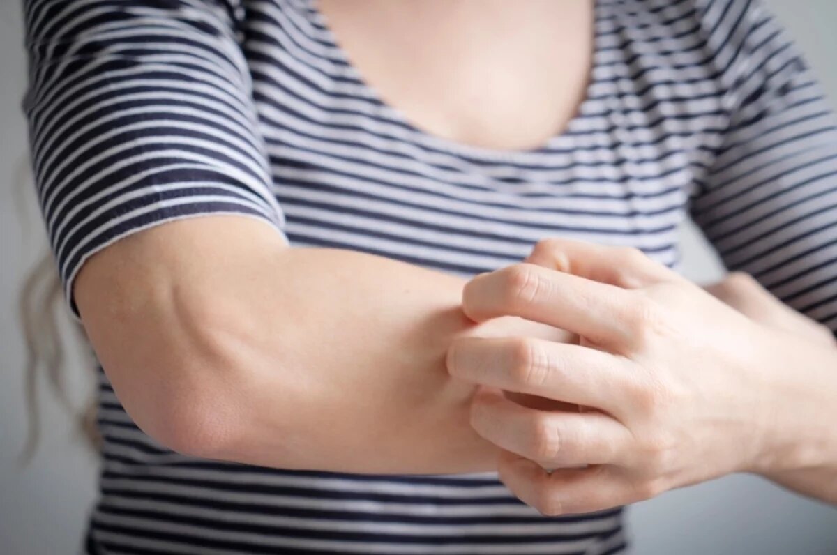    Признак паразита.