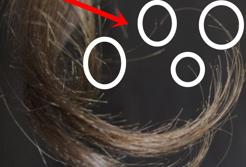 Как остановить ВЫПАДЕНИЕ и СЕЧЕНИЕ волос весной?