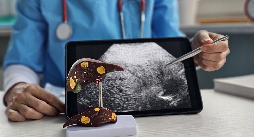 Врач назвал главные причины жировой болезни печени, требующей трансплантации