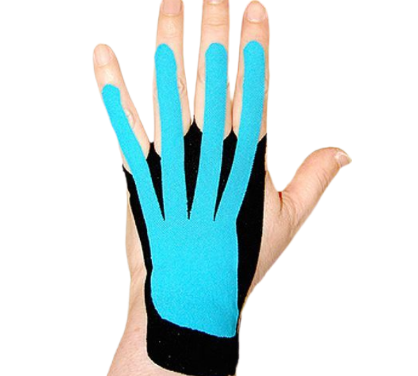 Тейпирование кистей рук и пальцев у больного перенёсшего инсульт.