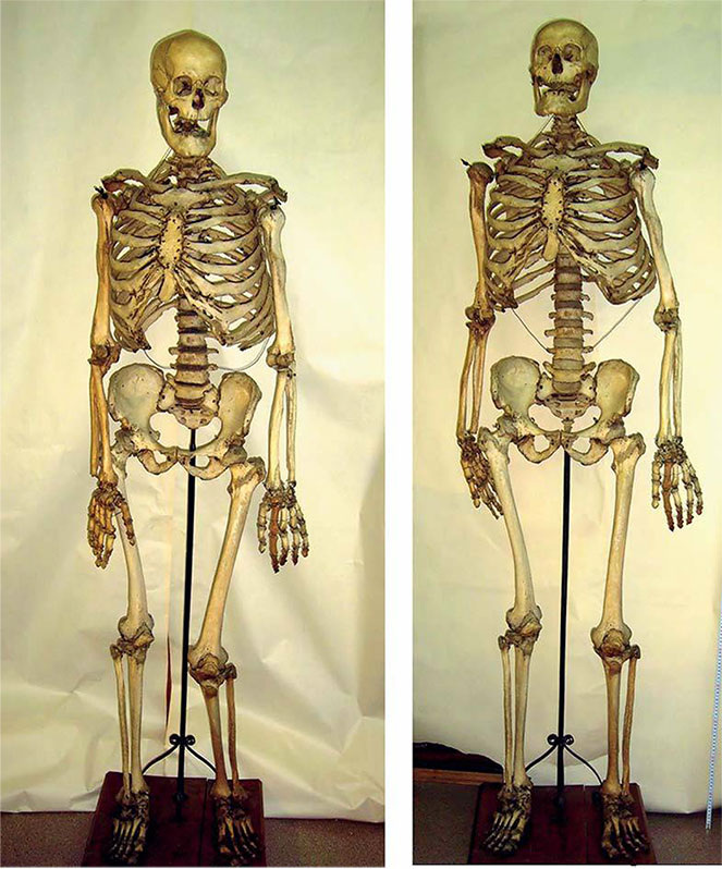 Скелет Николая Буржоа