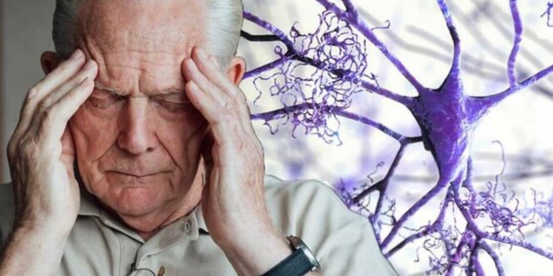 Ревматоидный артрит & деменции